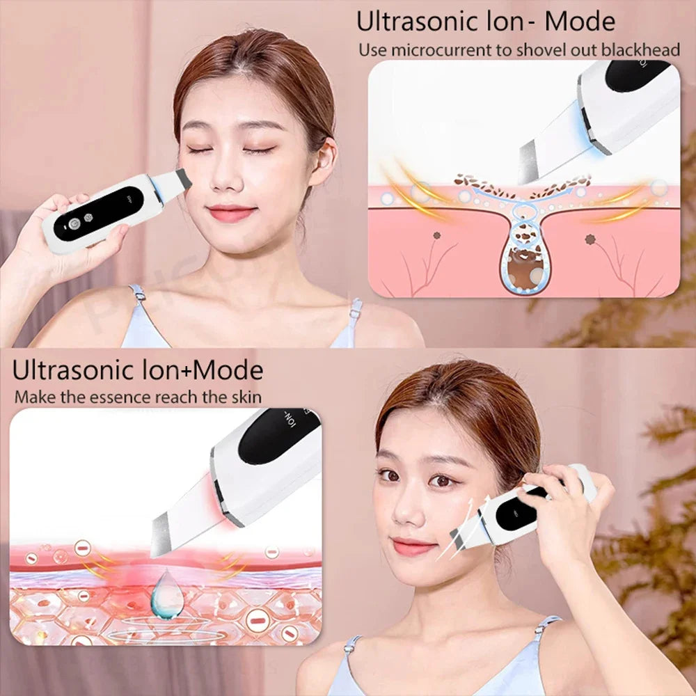 Ultrasonic Facial Scrubber