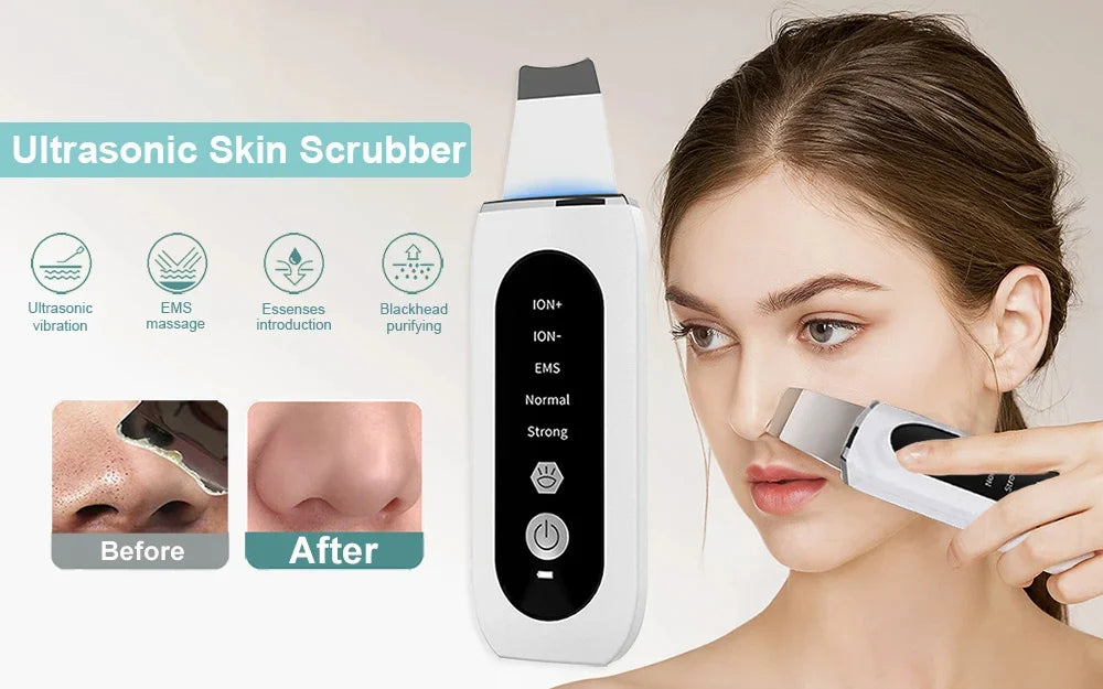 Ultrasonic Facial Scrubber