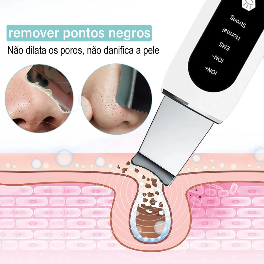 Ultrasonic Facial Scrubber