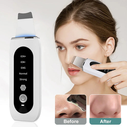 Ultrasonic Facial Scrubber